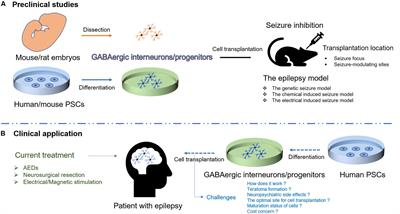 Cortical GABAergic Interneuron/Progenitor Transplantation as a Novel Therapy for Intractable Epilepsy